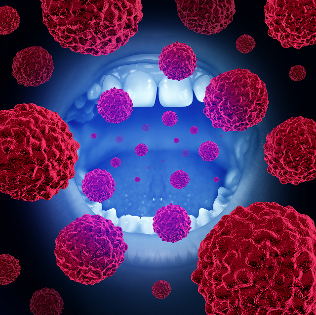 oral cancer_LR
