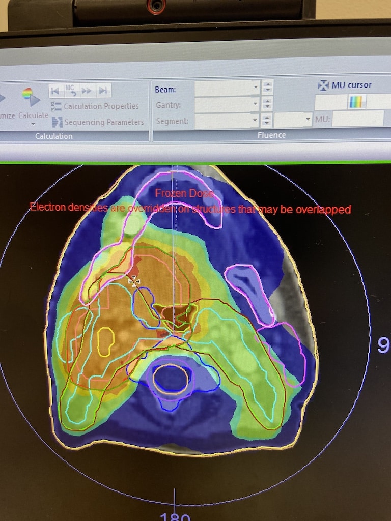 Diagnostic scan for head and neck cancer